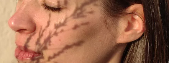 Votre diagnostic de peau